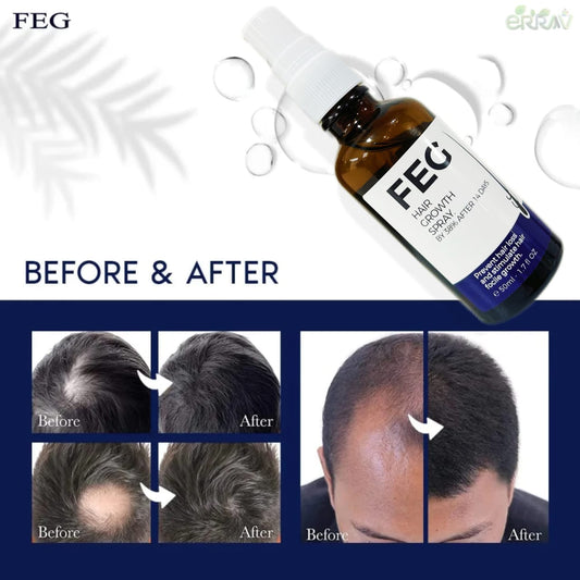 FEG Hair Growth Spray with Free Derma Roller